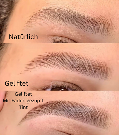 Brow Lift