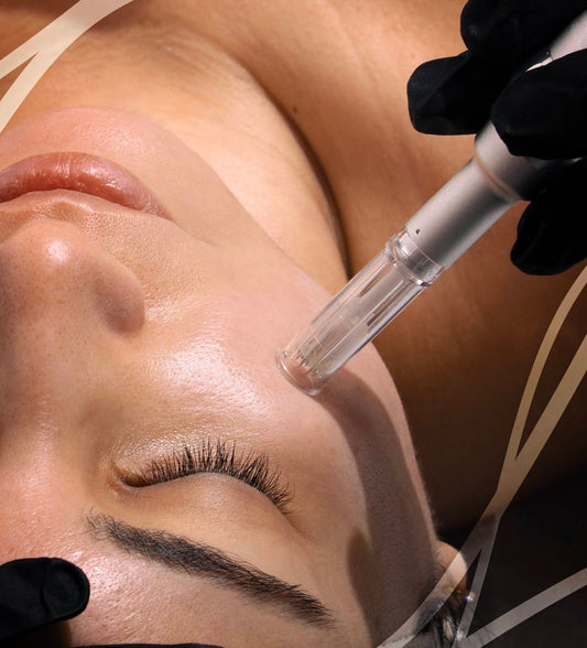 Microneedling