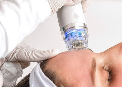 RF-Microneedling